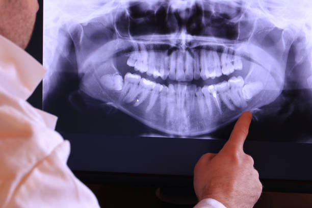 Best Emergency Care for Gum Disease in Mountain House, CA