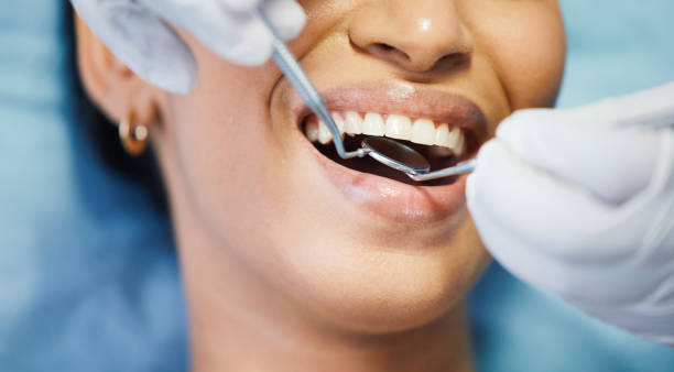 Best Emergency Treatment for Oral Infections in Mountain House, CA